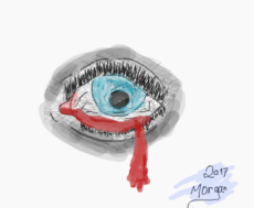 Bloody eye