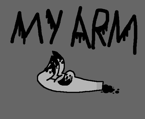 My arm