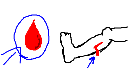 sangue
