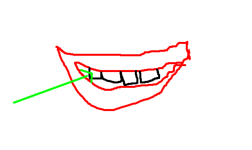dente