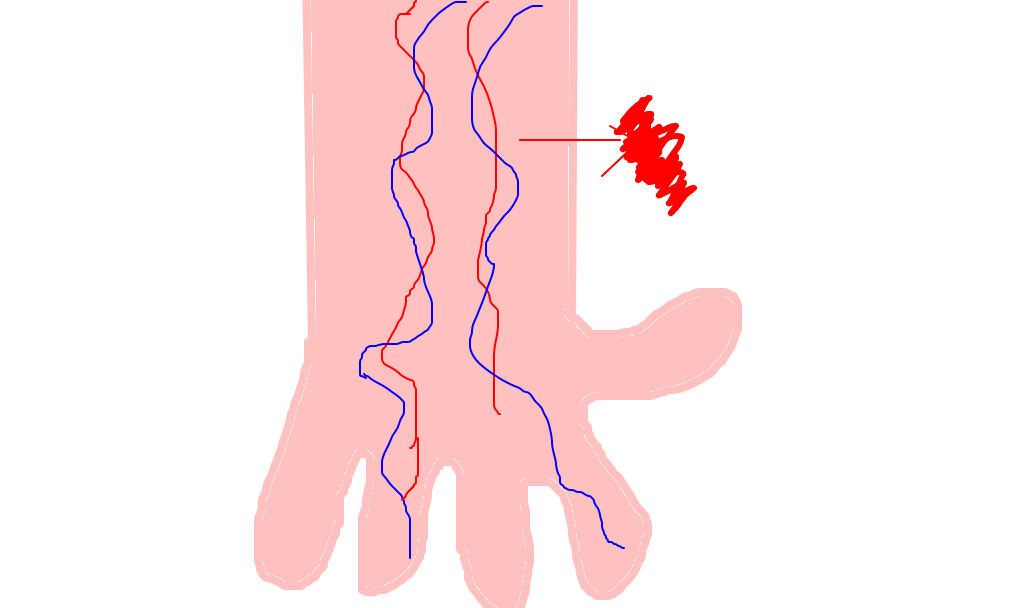 artéria